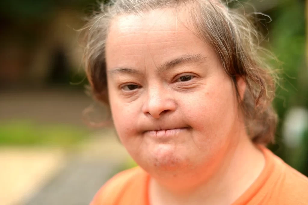 Disabled woman smiling at camera